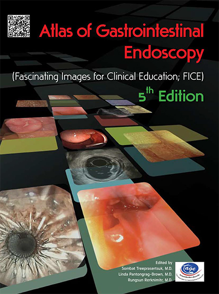 SAMPLE PAGE Atlas of Gastrointestinal Endoscopy : 5th Edition
