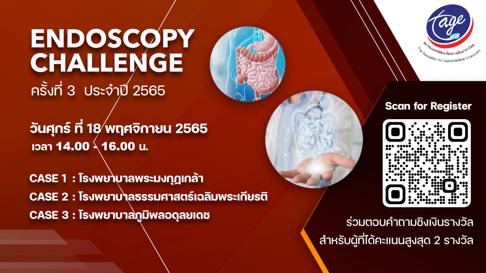 งานประชุม Endoscopy Challenge ครั้งที่ 3 ประจำปี 2565